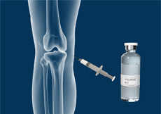 Combined Hyaluronic Therapy for the Knee