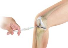 Cortisone Injection