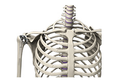 Outpatient Joint Replacement