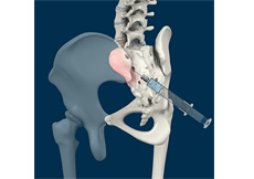 Peripheral Joint Injections