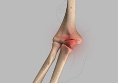 Total Joint Rehabilitation